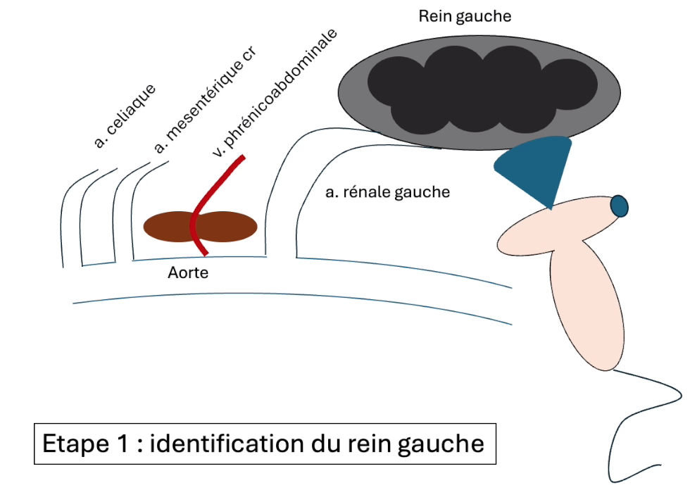 Identifier les glandes surrénales à l'écho