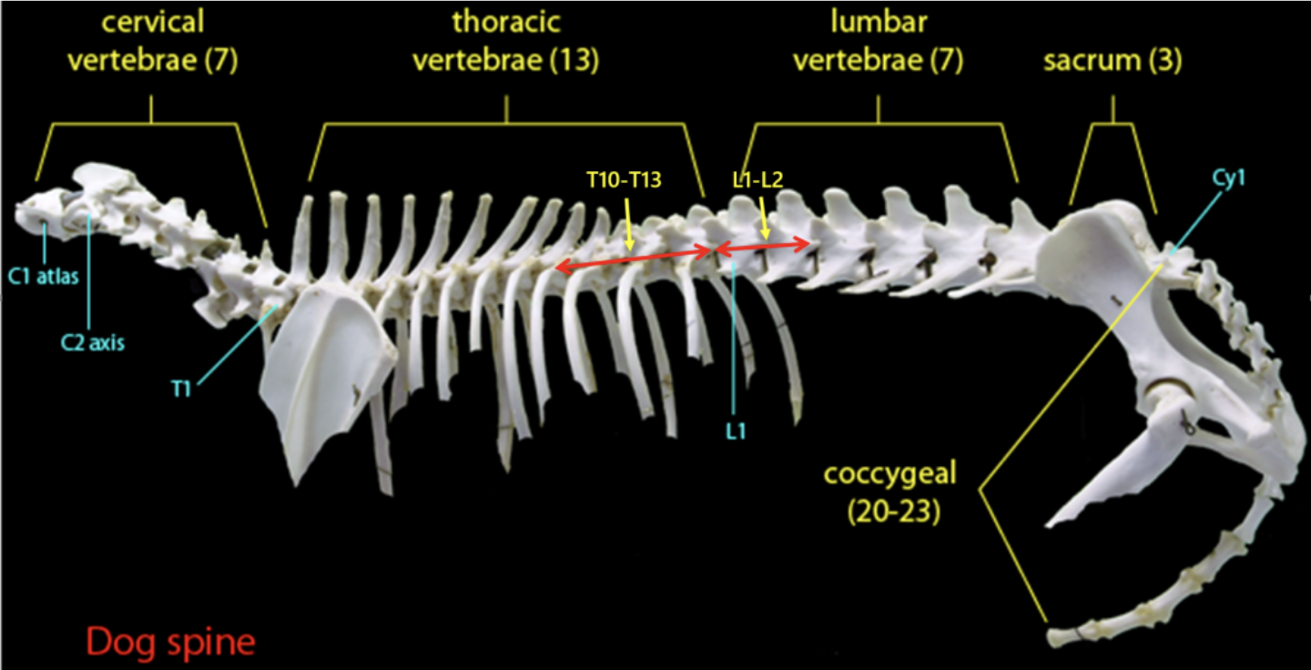 Les démarches et stades neurologiques et myélopathie T3-L3 en vidéo